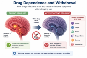 https://siddhaspirituality.com/wp-content/uploads/2026/06/Drug-Withdrawal-300x200.png